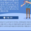 기흉 증상 및 원인과 치료(수술) 폐기흉 이미지