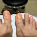 매료네일 문제성전문점 이미지