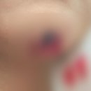 제나성형외과의원 네이버블로그