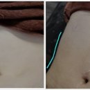 긋시아피부관리 네이버블로그