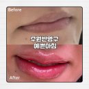 경기도 수원시 영통구 매탄로79번길 | 수원반영구 입술문신 잘하는 곳 예쁜아침 솔직 후기