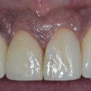 청담치과기공소 이미지