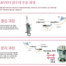 [하베스트젯] 자연스러운 가슴성형 - 연세로즈웰의원 청주점 이미지