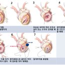 쌈지부전