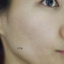 skin bara beauty(스킨 바라 뷰티) | 뉴아 뷰티디바이스 가정용 고주파기기 선택한 언박싱 후기