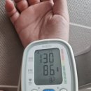 100만원살기) 뇌진탕으로 응급실 ㅠ 이미지