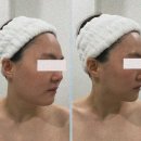 피부관리(얼굴) 이미지