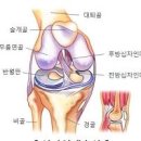 무릎통증 십자인대파열일까요? 이미지