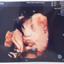 수서나을산부인과의원 이미지