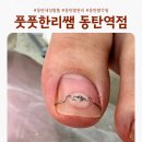 화담메디 | 풋풋한리쌤 동탄역점에서 내성발톱교정 받고온 후기
