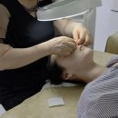피부전문관리샵 | 대전 여드름압출전문 피부관리 용문동 빔샵 후기