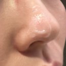 코미인의원 | 더피부과의원 부천타투제거(점)