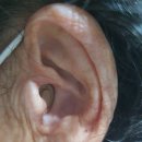 시그니아독일보청기대구북구센터 이미지