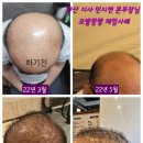 큐사랑 이미지