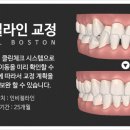 서울보스턴치과 이미지