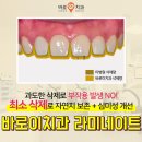 정도치과기공소 이미지