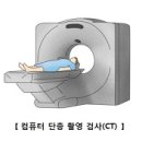 뇌 신경 정신질환 경추 추간판 탈출증(Cervical HIVD) 이미지