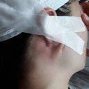 귀뒤 피지낭종 제거 후기 | 30분 만에 제거했어요 (건대성모외과)