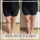 기원들화장실 | 압구정로데오) 유라인 지방분해주사 ‘허벅지컷주사’로 허벅지 사이 멀어지기 기원 1회차 후기