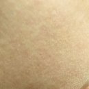 아크리스 | 여드름성 피부를 위한 여름철 완벽 케어 세트 – 아토뮤 아크리스 세럼 + 폼클렌저 사용 후기