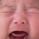 서울대 어린이병원 잠복고환 8개월아기 수술후기,수술과정-국내최고를 찾아서