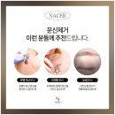 (주)자연스레 | 반영구 눈썹문신 잔흔제거 2회차 가격 및 이 주 경과 후기