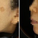 노바피부과의원 이미지