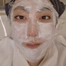 시전 | 피부과 여드름 흉터 쥬베룩 서브시전 시술 멍 통증 가격 후기