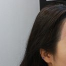 야시미구 | 동성로 헤어라인왁싱 브라질리언왁싱 남자왁싱하는곳/야시미구