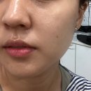 (주)지에스리테일 포항창포점 | [포항] 창포동 피부관리 '인셀덤' 후기