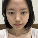 더플러스24의원 | 강남역피부과 추천 올피채강남 NDA 플러스 관리 후기