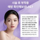클리니크후즈후의원 | 엘란쎄필러 얼굴의 볼륨 찾고 싶다면