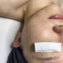 비브에스테틱 | 상무지구 웨딩관리 비브에스테틱 2개월 후기│본식 D-3 스킨부스터 예신관리