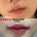 맑을아의원 네이버블로그