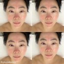 긴급 피부 처방도 잘하는 대구피부관리실, 수성구 자연을닮은피부관리실에서 n차 힐링하고 왔어요.