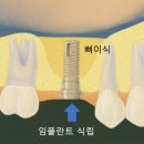 수성세이브치과의원 이미지