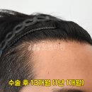 모엠의원 Daum카페