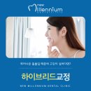 뉴밀레니엄치과의원 네이버블로그