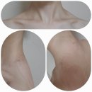 경희치과병원 | 경희유연한의원 어깨 굳어서 침맞고 풀고 온 후기