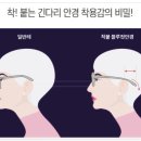 키다리안경 네이버블로그