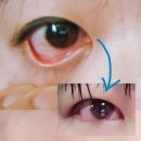 연수김안과의원 이미지