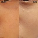 (주)집연구소 | 사계절 건조하고 예민한 피부 관리 후기 &#34;김애경 피부연구소&#34;