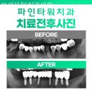 타워치과의원 네이버블로그