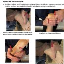 더 MECHANIC | Plantar Fasciopathy 족저근막 병증