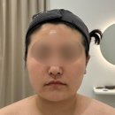 수원에스테틱 추천 다리아에스테틱 윤곽관리 후기