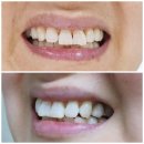 오랄디자인서울 | 덴타르트 분말치약 나만의 나이트루틴 아이템