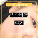 서울에스와이피부과의원 | 강남구청 피부과 리쥬란 쥬베룩 리쥬베룩 1주차 후기 내돈내산 찐후기