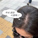 애터미(천안동남센터) | 천안탈모케어 웰킨두피탈모센터 신부점에서 만족스러운 두피스케일링 후기