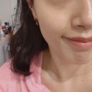 뷰티의신 | 마천동 피부관리 '뷰티의신' 스킨케어 플라즈마 + LDM 관리 후기