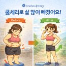 쿨한의원 네이버블로그
